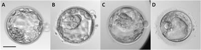 Nitrite and Nitrate Levels in Follicular Fluid From Human Oocyte Donors Are Related to Ovarian Response and Embryo Quality